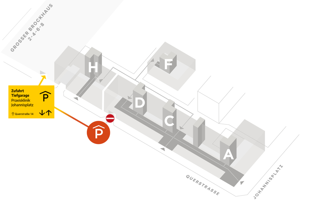 Zufahrt Ersatz-Tiefgarage_Praxisklinik am Johannisplatz Leipzig Skizze für die Zufahrt zur Ersatz-Tiefgarage, Querstraße 14